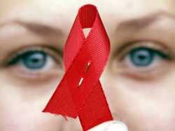 HIV e Assistenza al paziente malato di AIDS