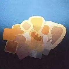 idrocolloidi