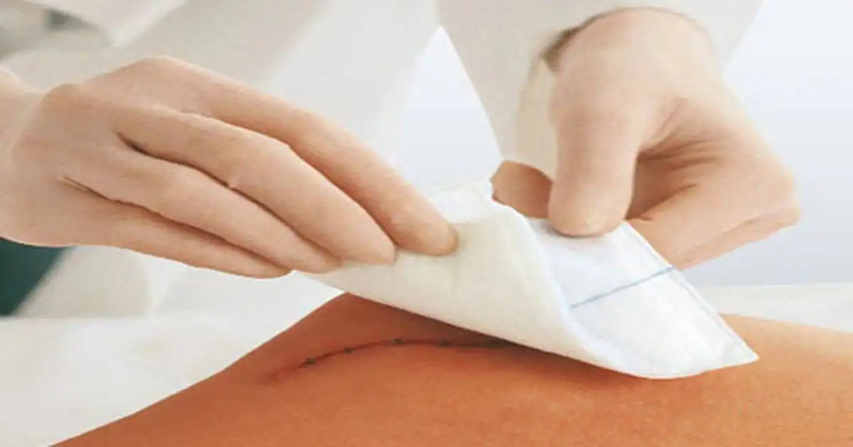 OSS esegue una medicazione semplice
